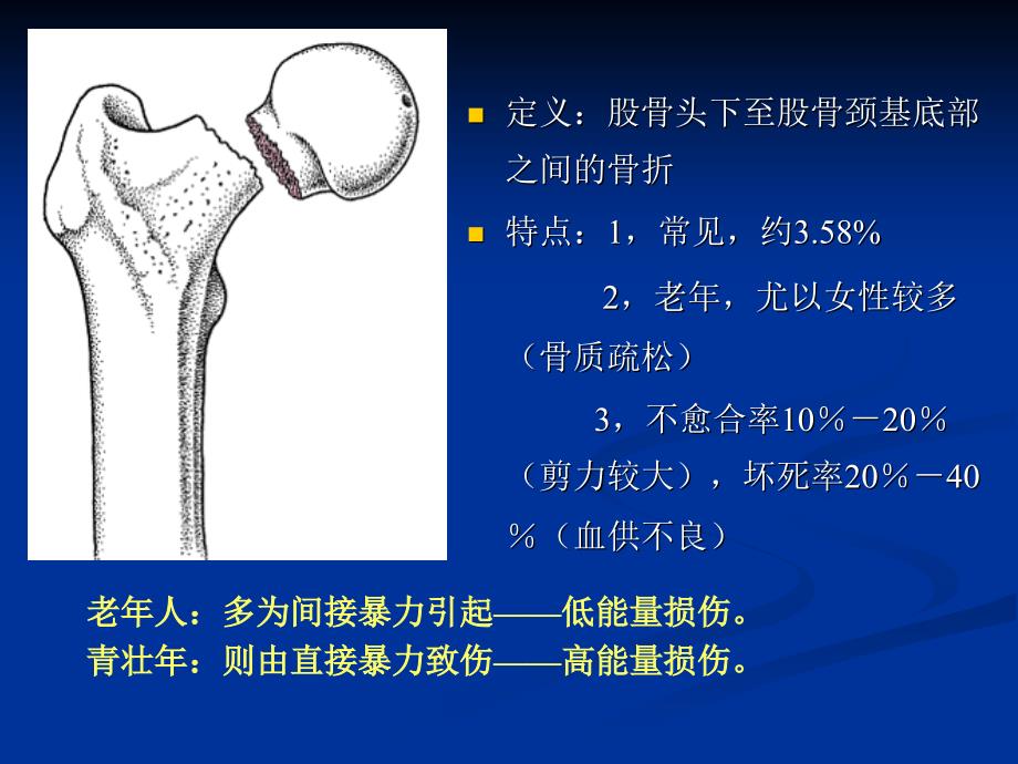 股骨颈骨折的治疗和护理   张付珍课件_第3页