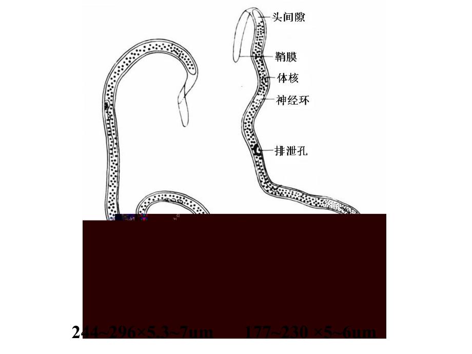 丝虫肝吸虫姜片虫课件_第2页