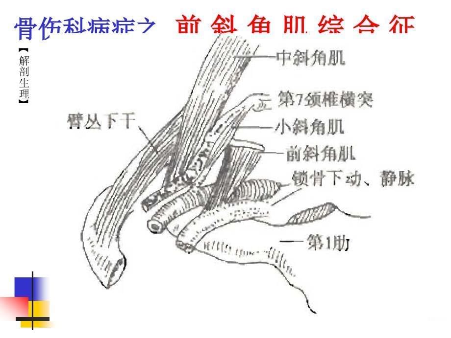 前歪角肌综合征新版课件_第5页