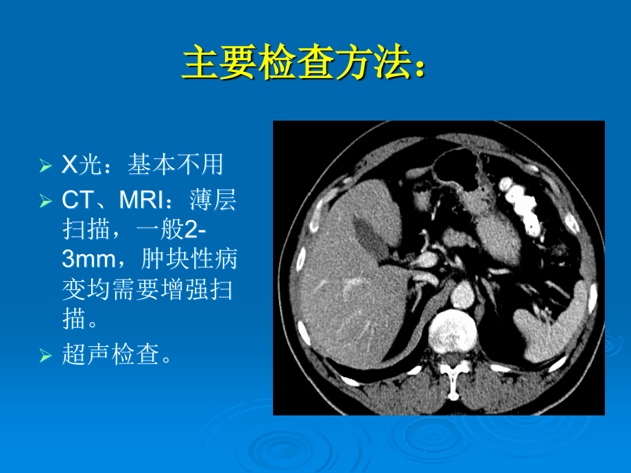 肾上腺疾病图文课件_第2页