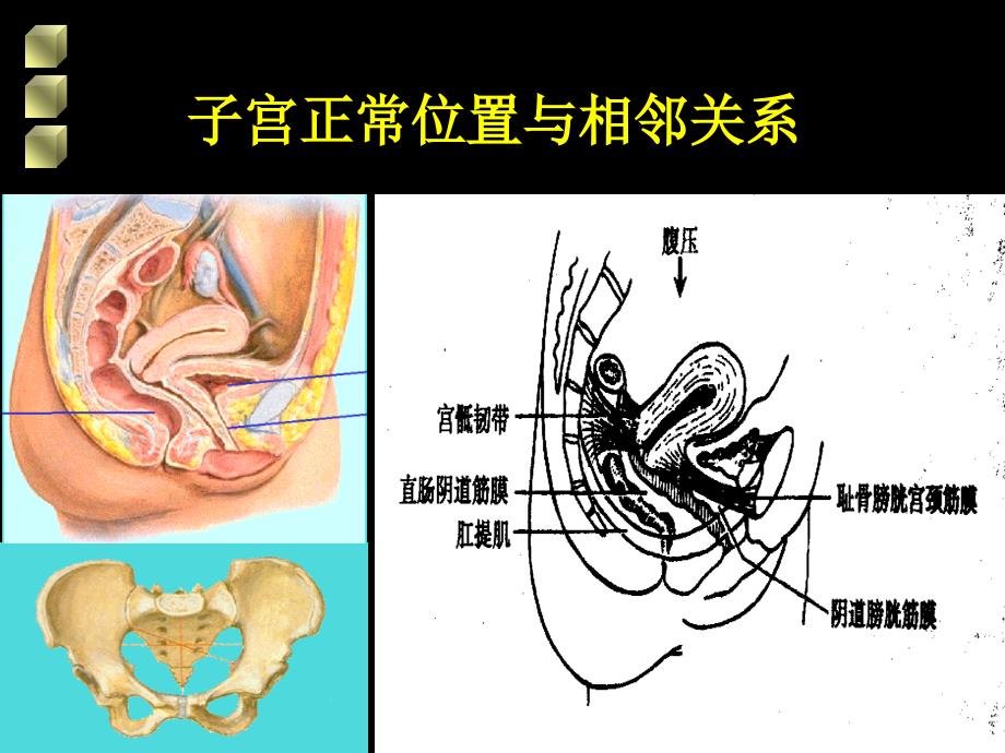 女性生殖道损伤性疾病课件_1_第4页