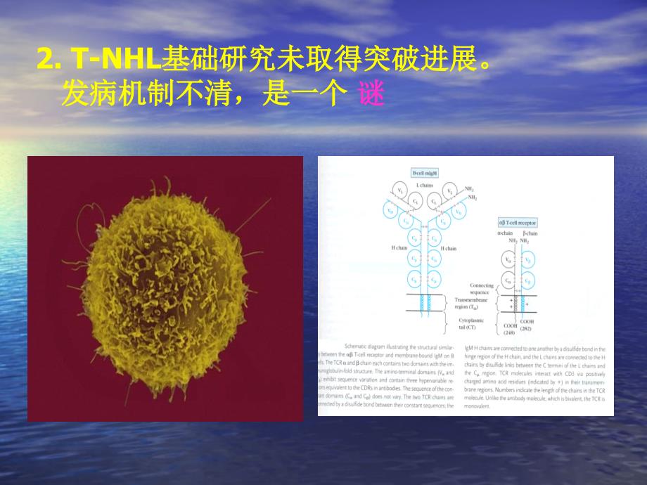 细胞非霍奇金淋巴瘤诊疗进展课件_2_第4页