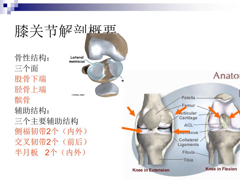 膝关节损伤课件_第3页