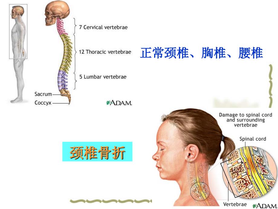 脊柱骨折与脊髓损伤病人的护理 powerpoint 演示文稿课件_第3页