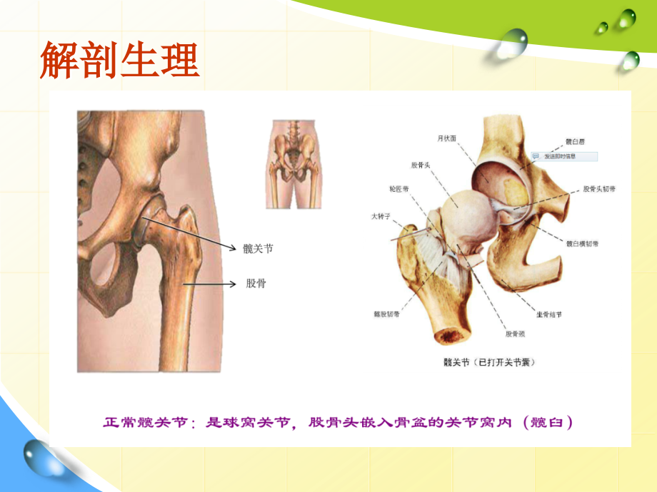 股骨头置换术后个案查房精要课件_第3页