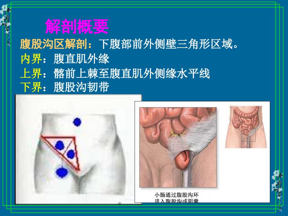 外科护理学课程课件16 腹外疝的护理_第4页