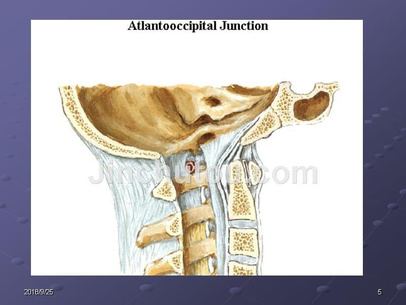 寰枢椎不稳及脱位课件_第5页