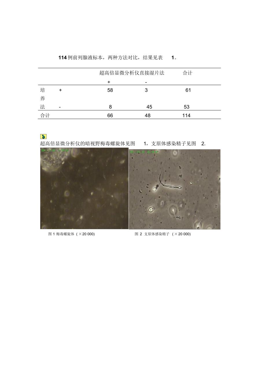 运用超高倍显微分析仪检查前列腺液的临床价值888_第4页