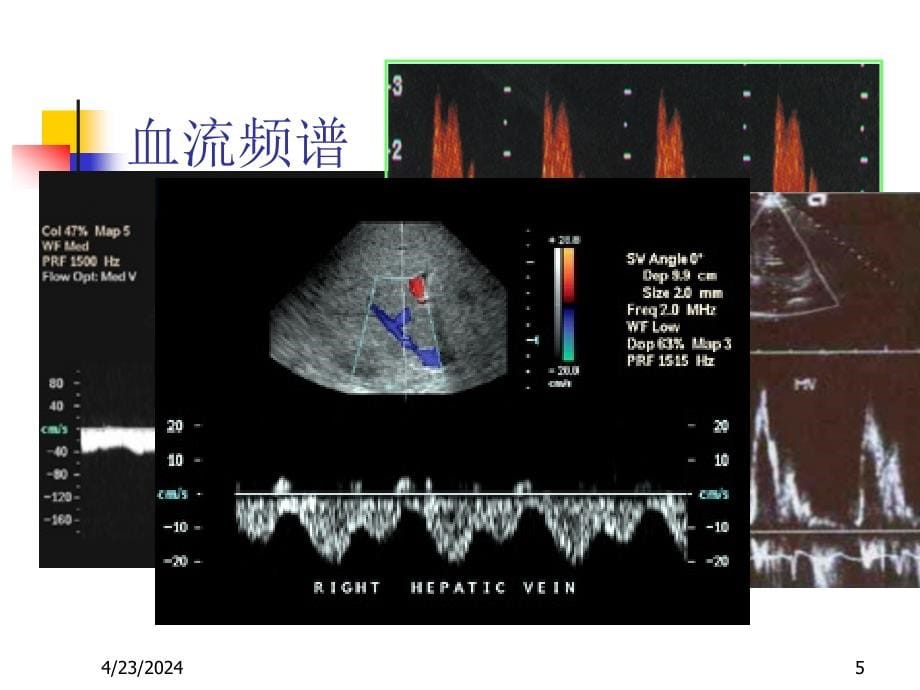 20081008肝胆胰脾超声_第5页