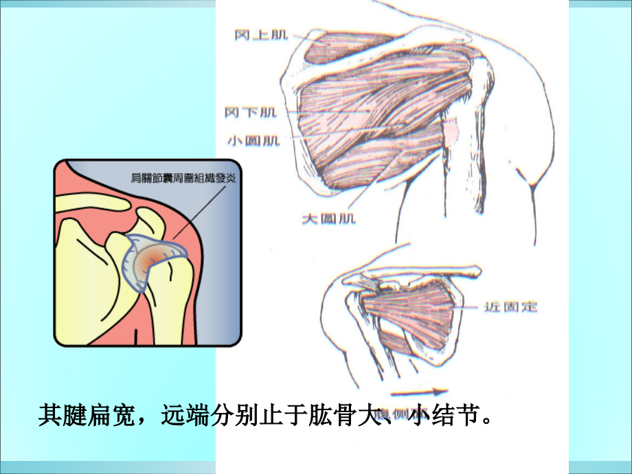 运动伤病防治第七章人体各部位运动损伤-课件_第4页