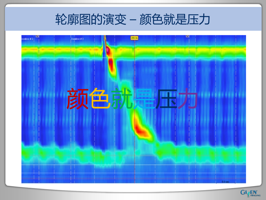 ManoScan食管测压测酸培训_第4页