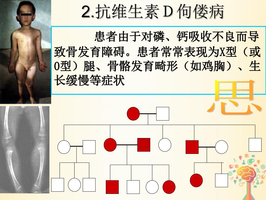 江西省吉安县高中生物 第二章 基因和染色体的关系 2.3 伴性遗传（课时2）课件 新人教版必修2_第3页