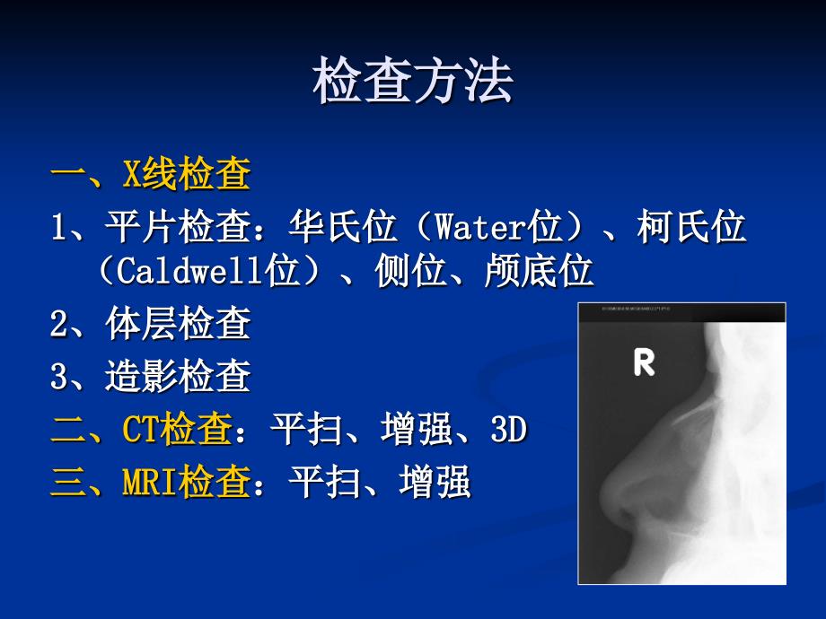 鼻和副鼻窦概要课件_第4页