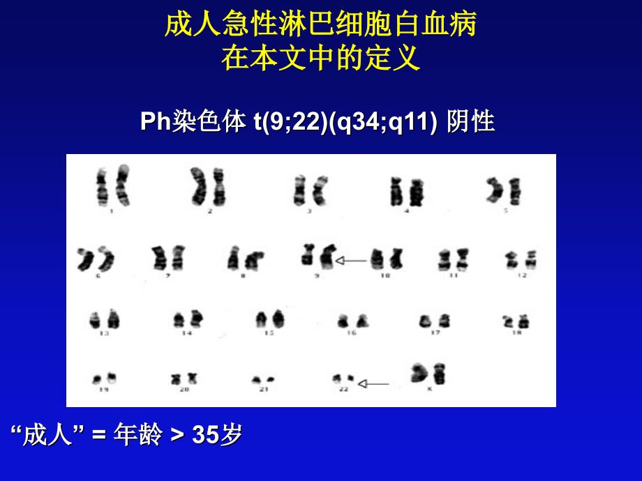 成人年龄gt35岁成人急性淋巴细胞白血病背景儿童课件_第2页