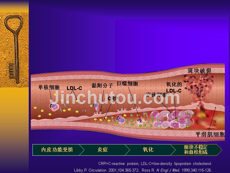 宝典急性心肌梗死诊疗课件_第3页