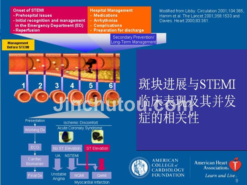 宝典急性心肌梗死诊疗课件_第4页