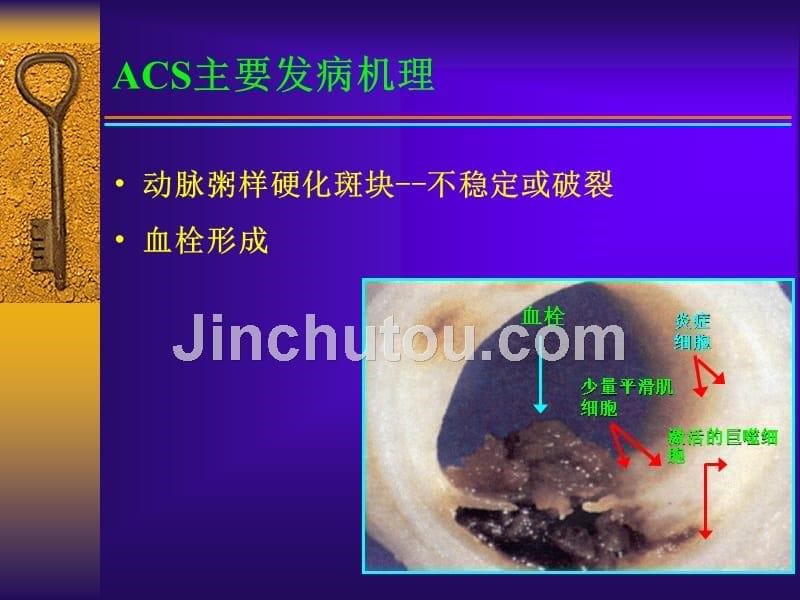 宝典急性心肌梗死诊疗课件_第5页