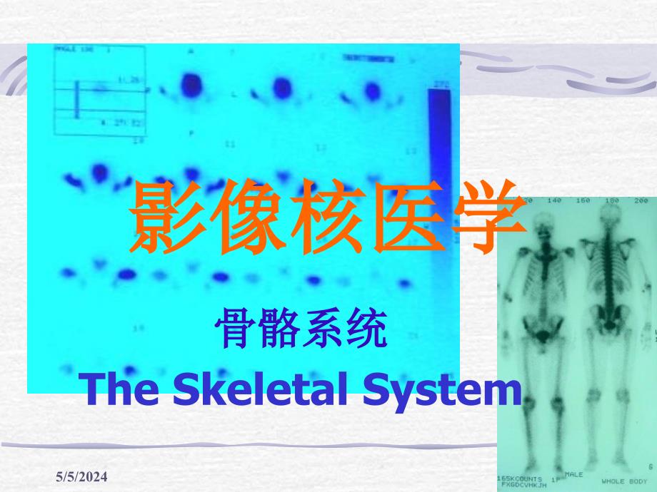 《核医学骨骼系统》ppt课件_第1页