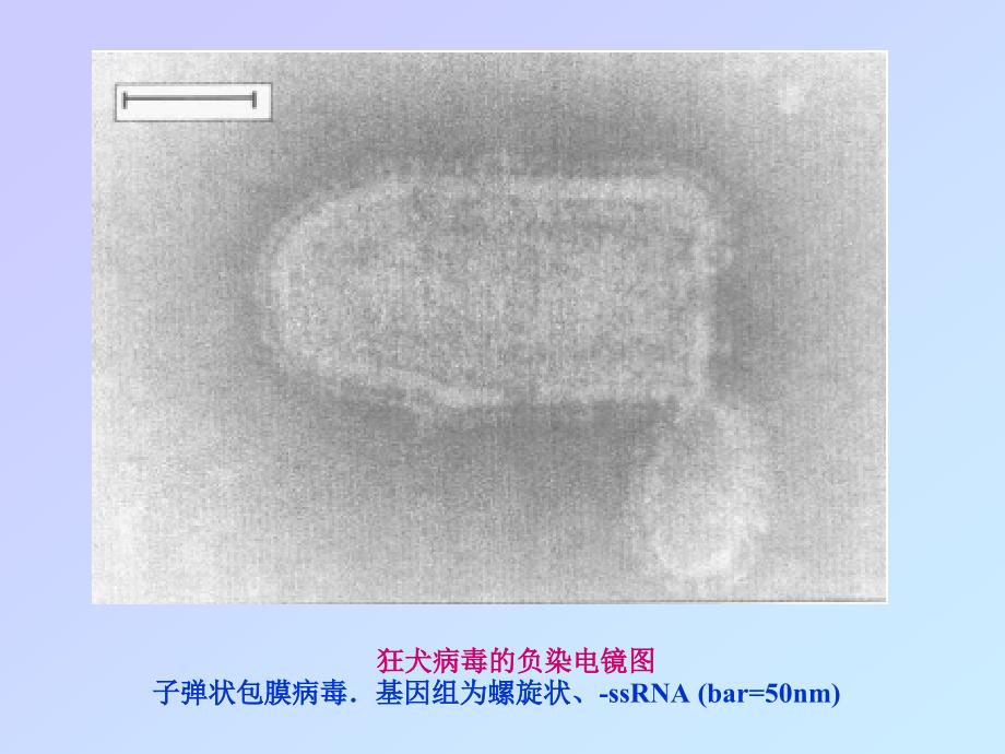 狂犬病病毒rabiesviru_第4页