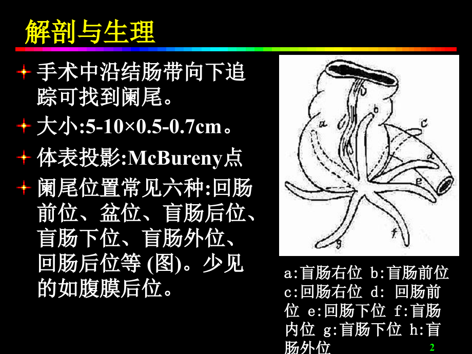 《阑尾炎acutea》ppt课件_第2页