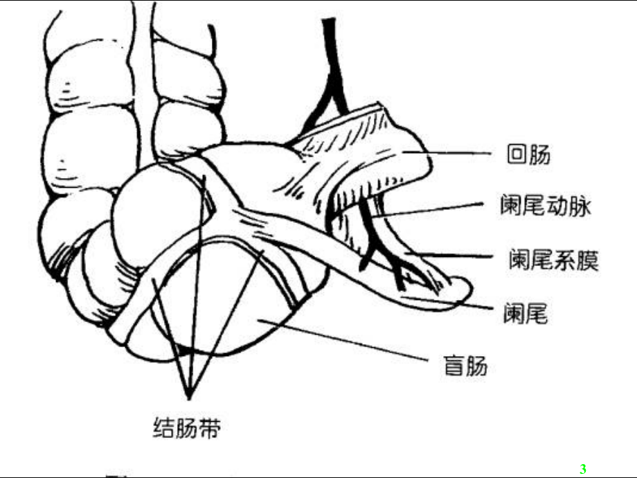 《阑尾炎acutea》ppt课件_第3页