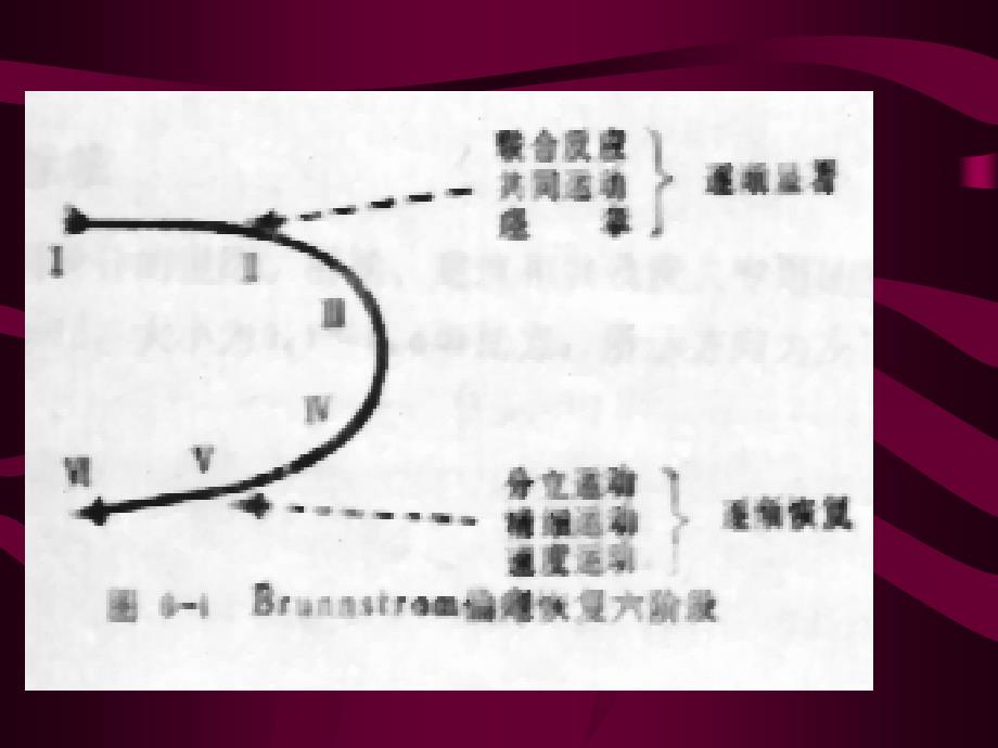 〖医学〗脑血管意外的康复_第4页