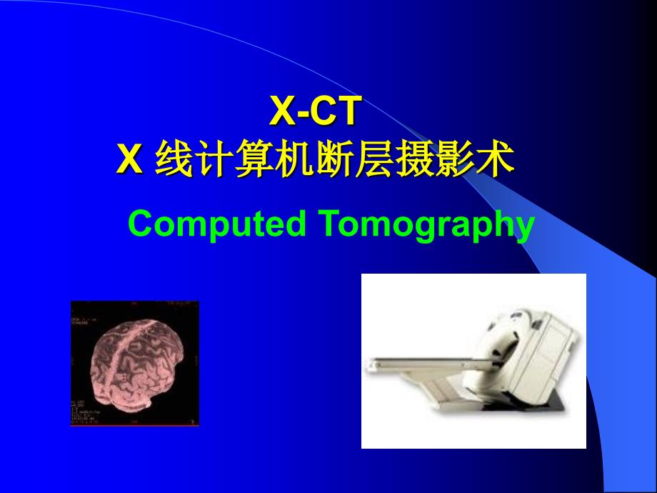 《ct成像原理》ppt课件_第1页