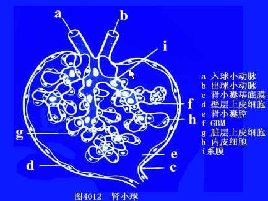 病理学泌尿系统疾病5年_第5页