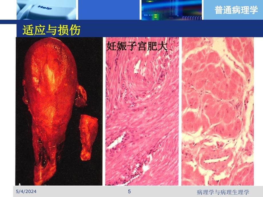 《适应损伤修复》ppt课件_第5页