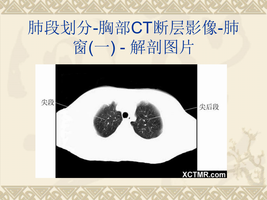 【6A文】全身CT断层解剖详细实用图解_第3页