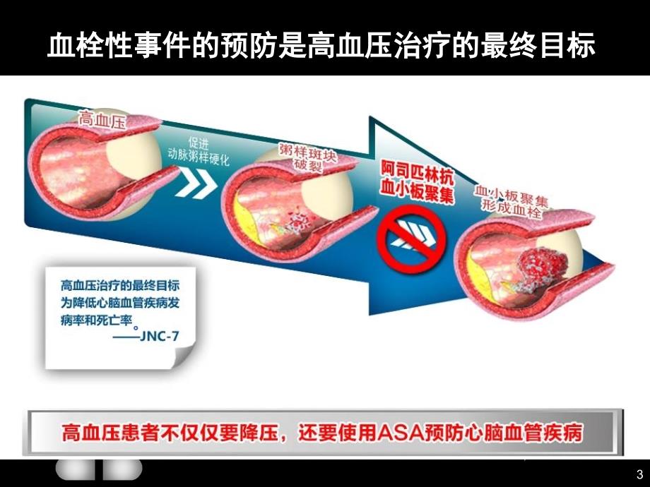 岁以上高血压患者推荐使用阿司匹林_第3页