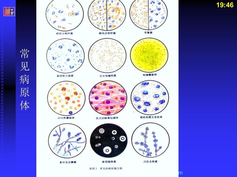 《传染科常见病》ppt课件_第5页