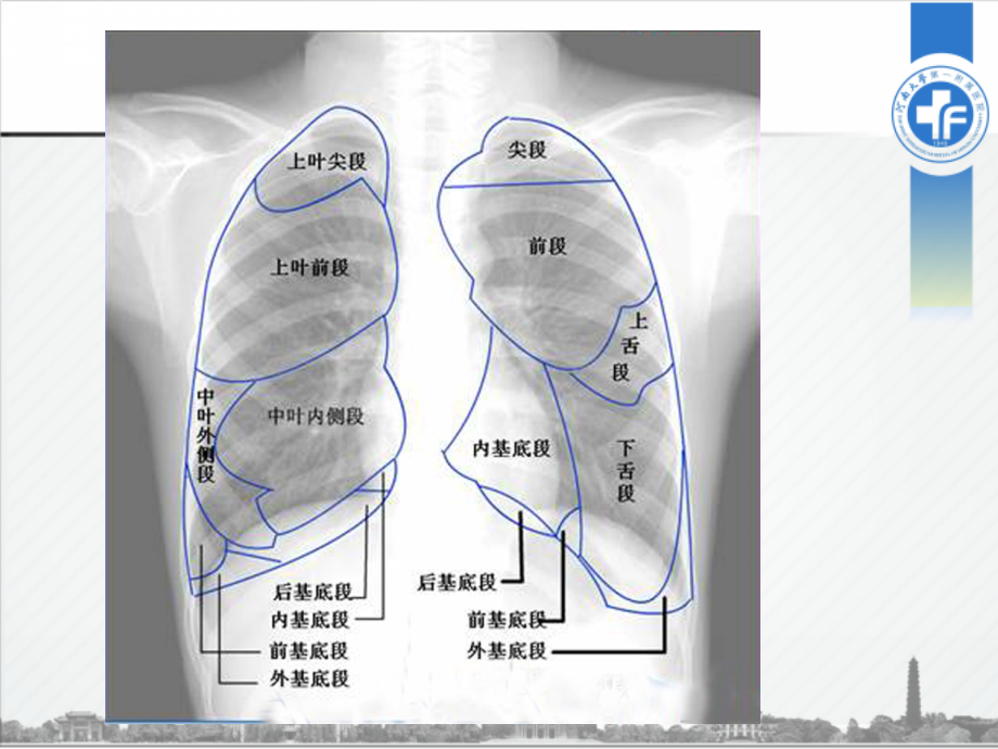 【6A文】肺叶-肺段CT图解_第4页
