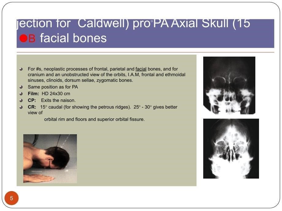 new-skull头颅影像学_第5页