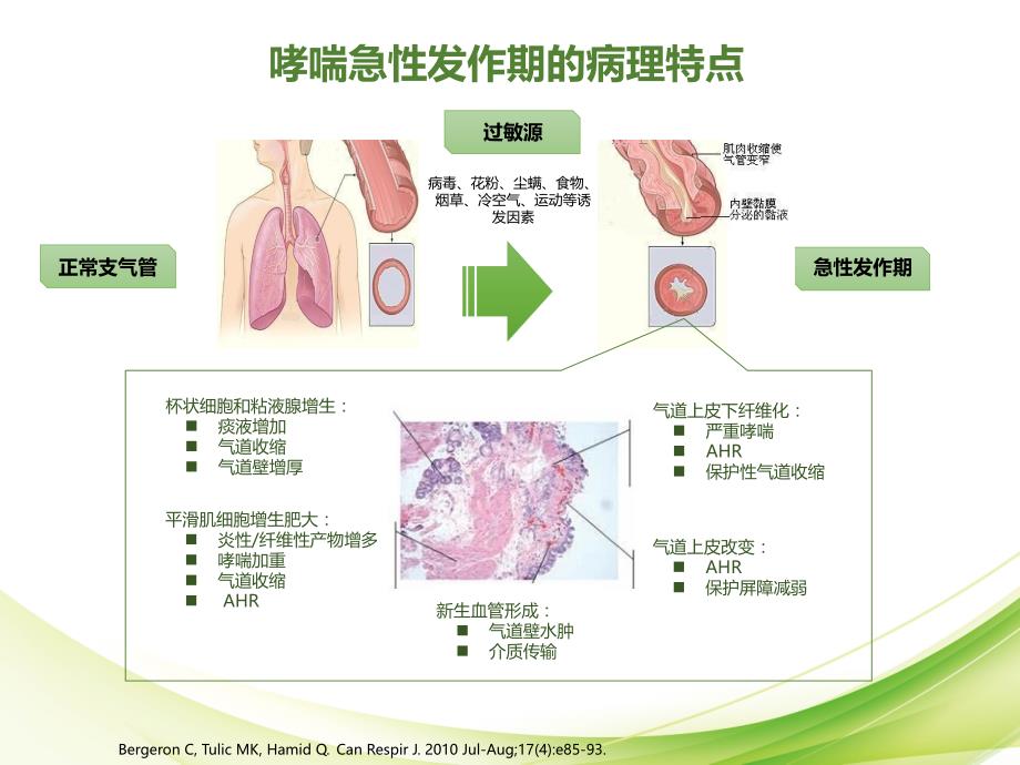 急性期幻灯1-急性期雾化BUD治疗剂量篇-审批通过-标注完成_第2页