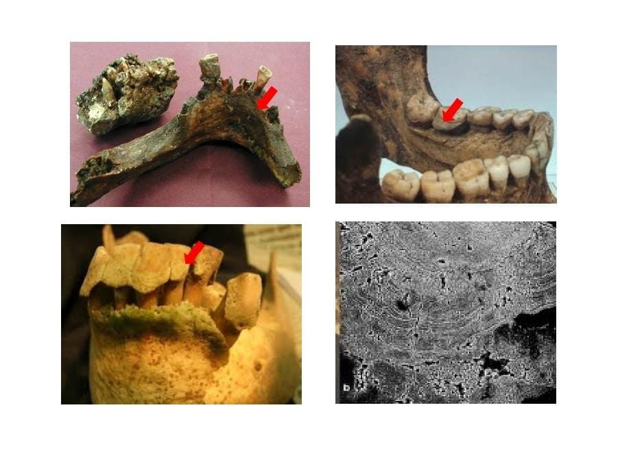 口腔微生物学3牙菌斑-_第5页