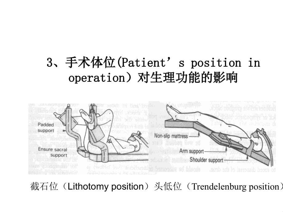 腹`盆腔手术的麻醉_第5页