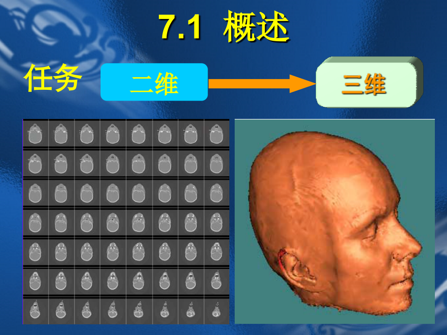 医学]医学成像技术第八章_三维重建技术_第2页