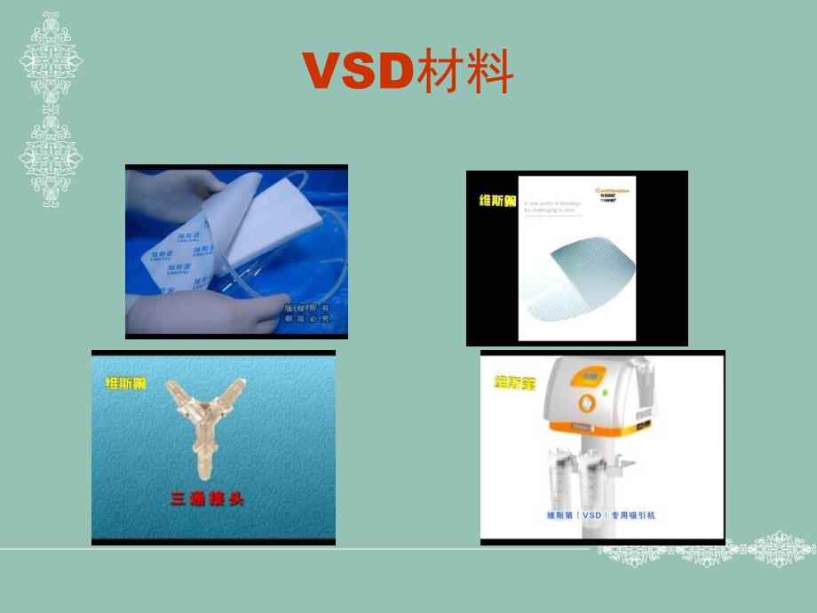 vsd(负压吸引技术)的概述_第3页