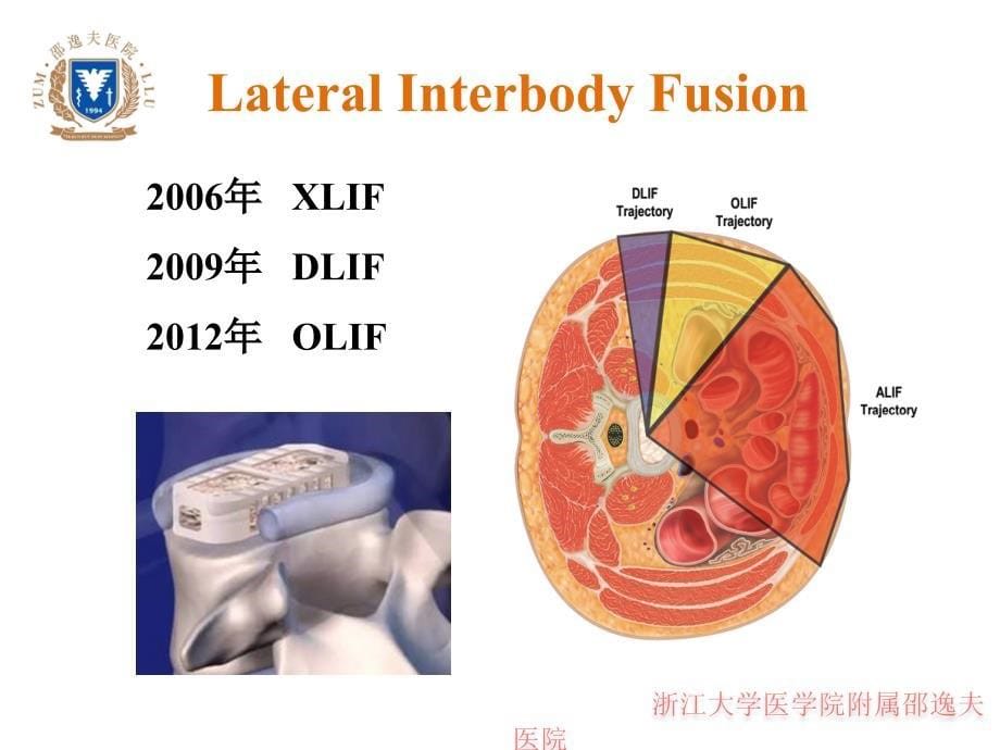 olif入路和相关解剖_第5页