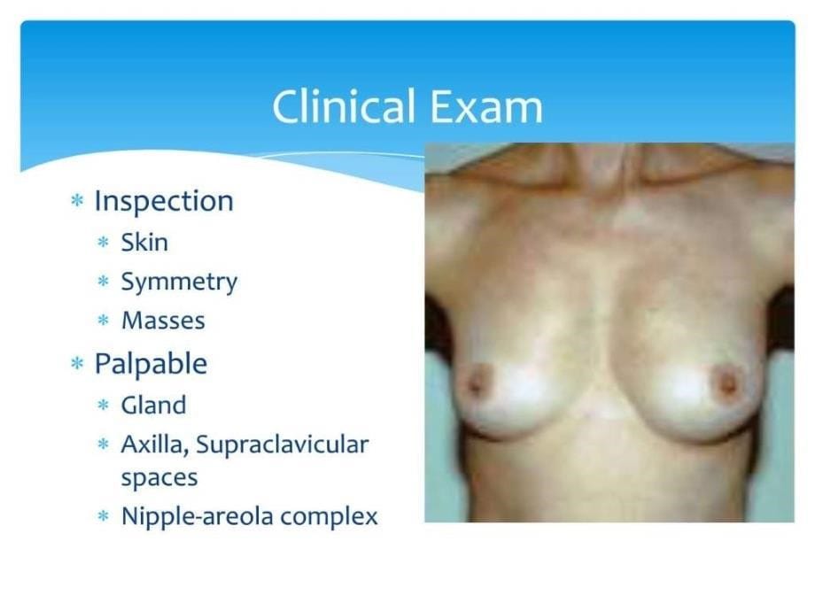 乳腺疾病课件-英文版-1_第5页