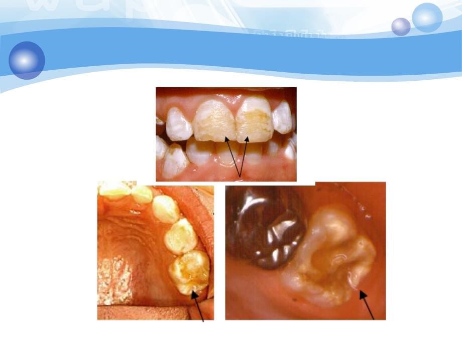 《牙体牙髓》10.10牙体牙髓病_第5页