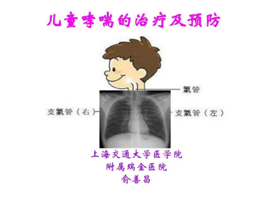 儿童哮喘的治疗及-俞教授_第1页