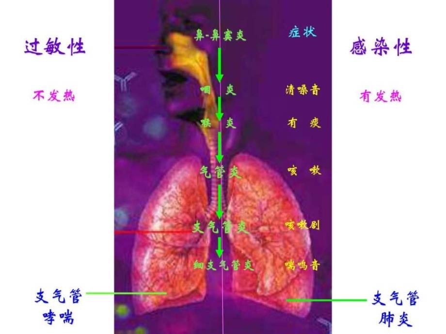 儿童哮喘的治疗及-俞教授_第4页