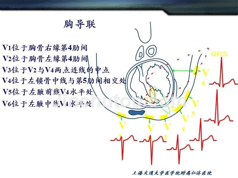 《心电图的基本知识》ppt课件_第5页