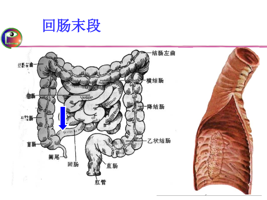 《病理生理学教学资料-王槐高》病理 传染病_第4页