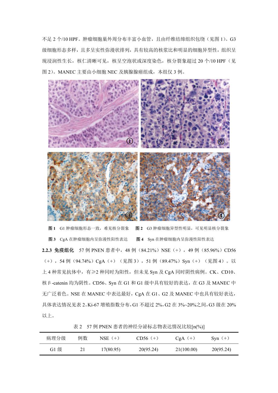 原发性胰腺神经内分泌肿瘤病理特征临床分析_第3页