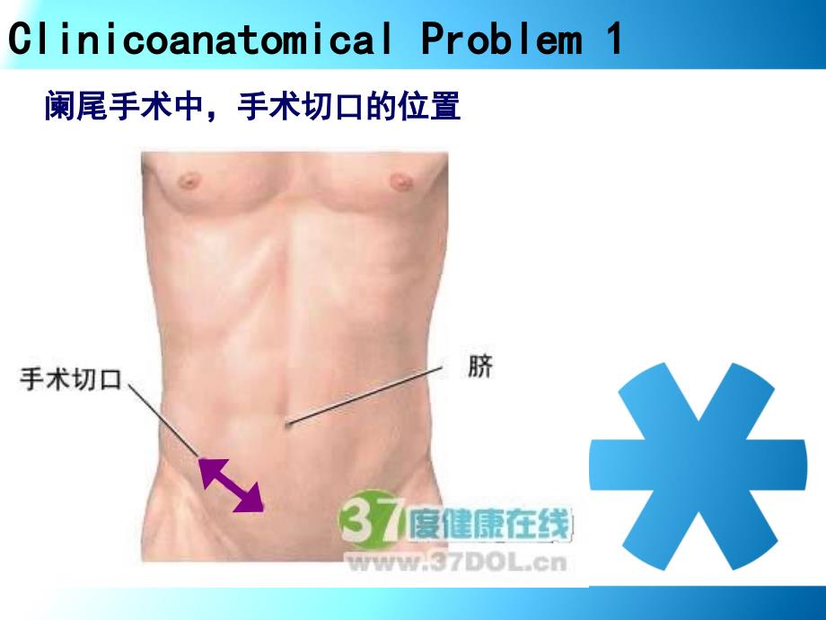 《腹部pblcase》ppt课件_第4页