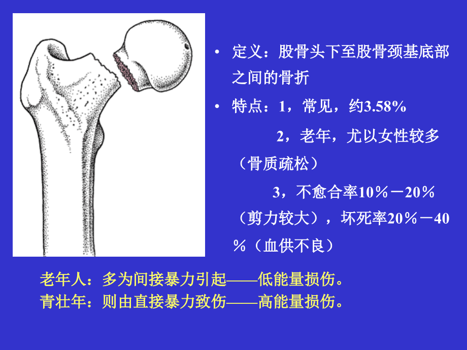 股骨颈骨折-骨科医院_第2页