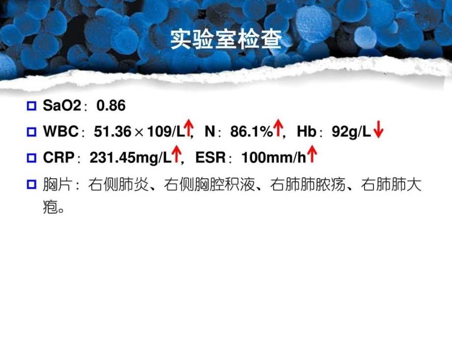 肺炎链球菌性疾病的治疗挑战和反思_第4页